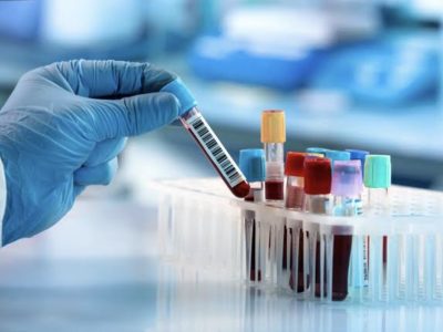 ارائه بیش از ۲میلیون خدمت آزمایشگاهی در گلستان